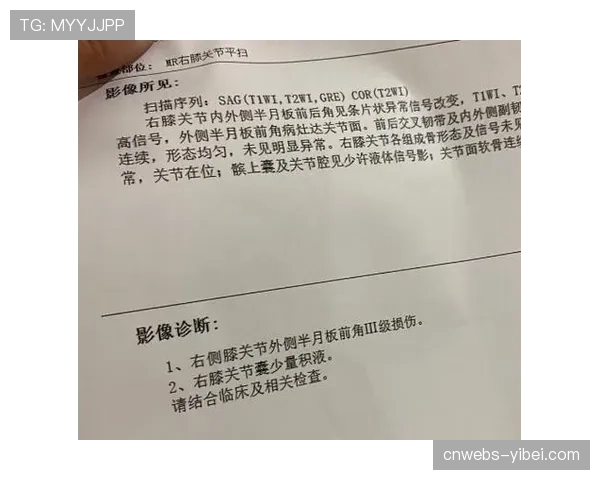 克雷桑左膝半月板韧带损伤,归期未定影响山东泰山进攻线 克雷桑左膝半月板韧带损伤,归期未定影响山东泰山进攻线